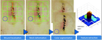 A Roadmap for Automatic Surgical Site Infection Detection and Evaluation Using User-Generated Incision Images
